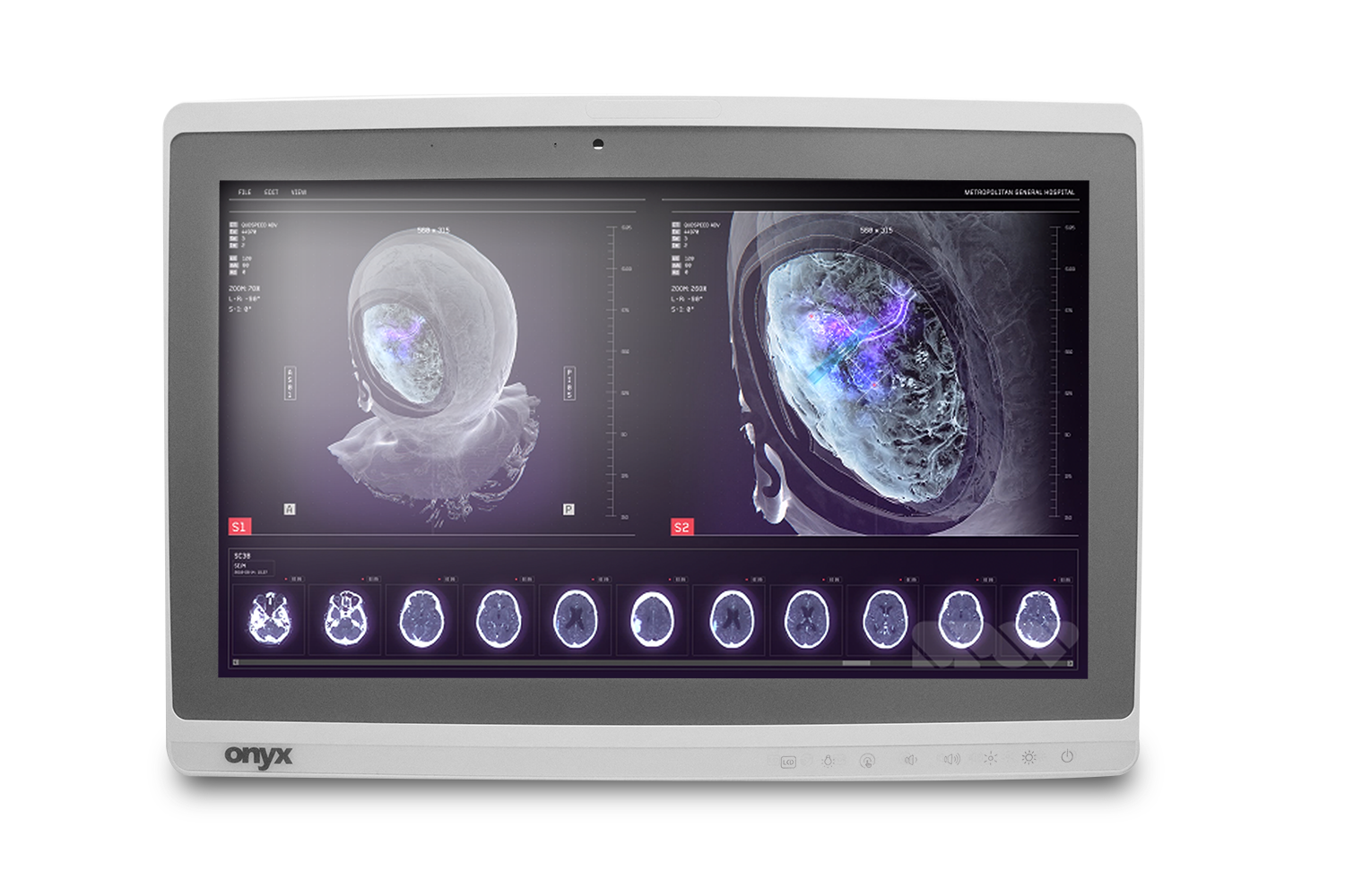 ONYX PC AIO 2121DTT ATOM D525/6/SSD240/W10PMAR/2Y