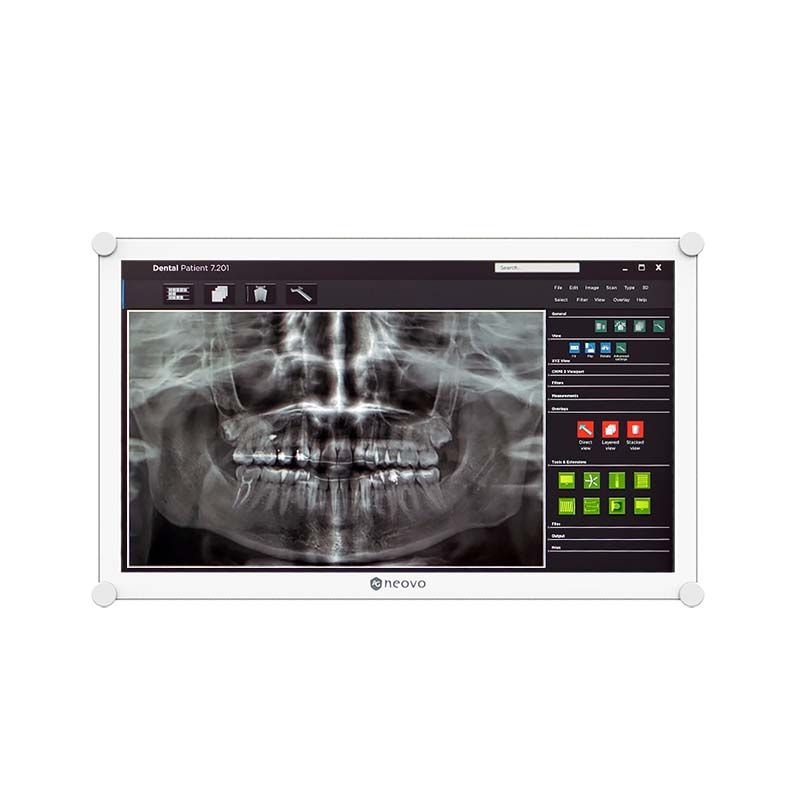 monitor dentale 22