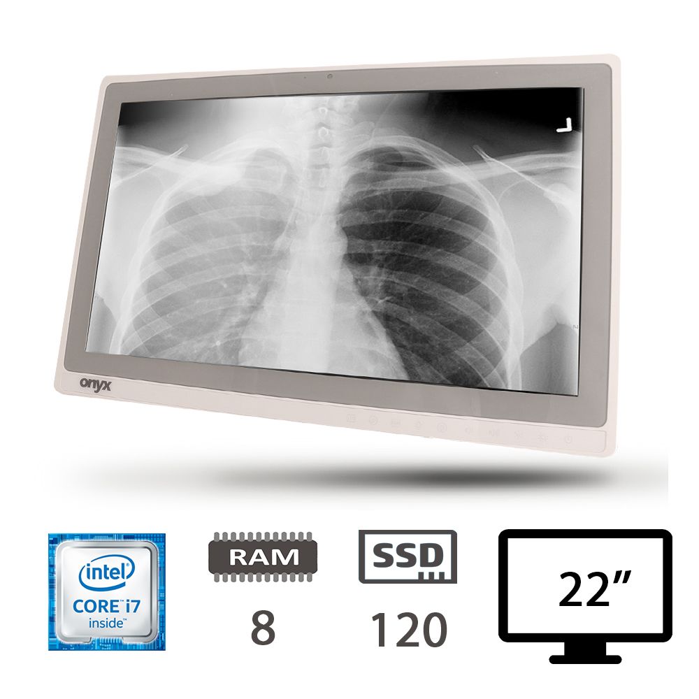 ONYX ZEUS AIO 228ST I7-6600U/8/SSD120/W10P/2Y